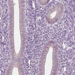 CLPSL1 Antibody in Immunohistochemistry (IHC)