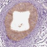 CLPSL1 Polyclonal Antibody