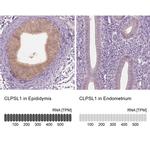 CLPSL1 Antibody