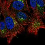 ABHD6 Polyclonal Antibody