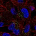 FAM78B Polyclonal Antibody