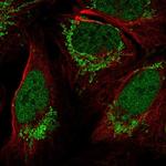 FOXB1 Polyclonal Antibody