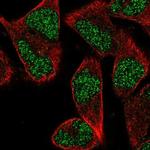 ZNF627 Polyclonal Antibody