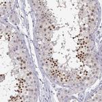 C16orf86 Polyclonal Antibody