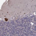 PCDHA4 Antibody in Immunohistochemistry (Paraffin) (IHC (P))