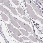 PCDHA4 Polyclonal Antibody