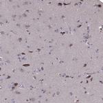 PCDHA4 Antibody in Immunohistochemistry (IHC)