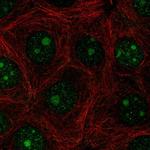PAQR6 Antibody in Immunocytochemistry (ICC/IF)