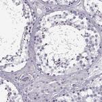 RNF32 Antibody in Immunohistochemistry (IHC)