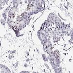 RNF32 Polyclonal Antibody