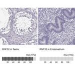RNF32 Antibody