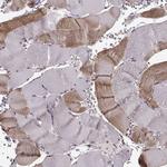 YIPF5 Antibody in Immunohistochemistry (Paraffin) (IHC (P))