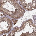 YIPF5 Antibody in Immunohistochemistry (Paraffin) (IHC (P))