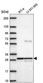 YIPF5 Antibody in Western Blot (WB)