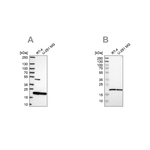 Sorcin Antibody in Western Blot (WB)