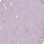 Sorcin Antibody in Immunohistochemistry (IHC)