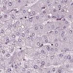 Sorcin Antibody in Immunohistochemistry (IHC)