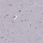 FEZF1 Polyclonal Antibody