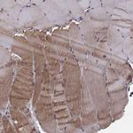 NUP37 Antibody in Immunohistochemistry (IHC)