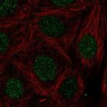 LMX1B Polyclonal Antibody