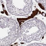 ZNF433 Antibody in Immunohistochemistry (IHC)