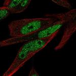 ZNF225 Polyclonal Antibody