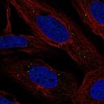 LMNTD2 Polyclonal Antibody