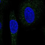 SNX24 Polyclonal Antibody