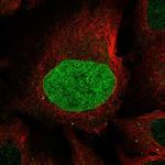 Calpain 8 Polyclonal Antibody