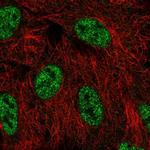 SMG1 Polyclonal Antibody