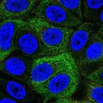 SRMS Polyclonal Antibody