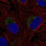 ZNF625 Polyclonal Antibody