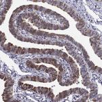 ADAM28 Antibody in Immunohistochemistry (Paraffin) (IHC (P))