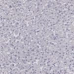 ADAM28 Antibody in Immunohistochemistry (Paraffin) (IHC (P))