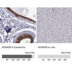 ADAM28 Antibody in Immunohistochemistry (IHC)