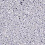 ADAM28 Antibody in Immunohistochemistry (IHC)