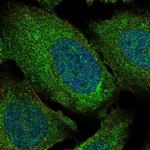 ADAM28 Polyclonal Antibody