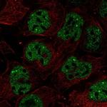 RNF34 Polyclonal Antibody