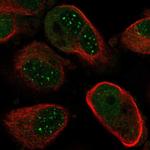 NUDT21 Polyclonal Antibody