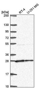 NUDT21 Antibody in Western Blot (WB)