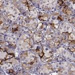 TGFBR3L Antibody in Immunohistochemistry (IHC)
