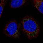 LETMD1 Polyclonal Antibody