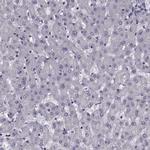 INTS3 Antibody in Immunohistochemistry (Paraffin) (IHC (P))