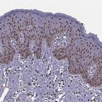 INTS3 Antibody in Immunohistochemistry (Paraffin) (IHC (P))