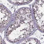 INTS3 Antibody in Immunohistochemistry (Paraffin) (IHC (P))