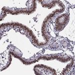 INTS3 Antibody in Immunohistochemistry (IHC)