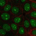 INTS3 Polyclonal Antibody