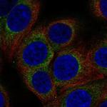 AP3D1 Polyclonal Antibody