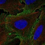 IL12RB1 Polyclonal Antibody