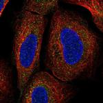 TMEM136 Polyclonal Antibody